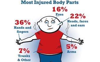 CPSC Infographic on fireworks injuries to body parts