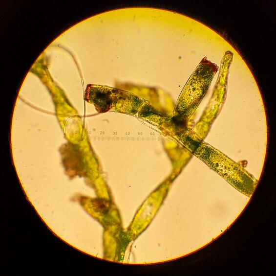 A specimen of Appalachian bristle-fern under magnification depicting gemmifer cells.