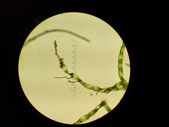 A specimen of Appalachian bristle-fern under magnification depicting rhizoids.