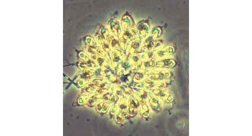 A colonial chrysophyte of the genus Synura, this organism is one of several phytoplankton taxa that can cause unpleasant taste and odors in water supplied to consumers. The colony is about 120 microns in diameter