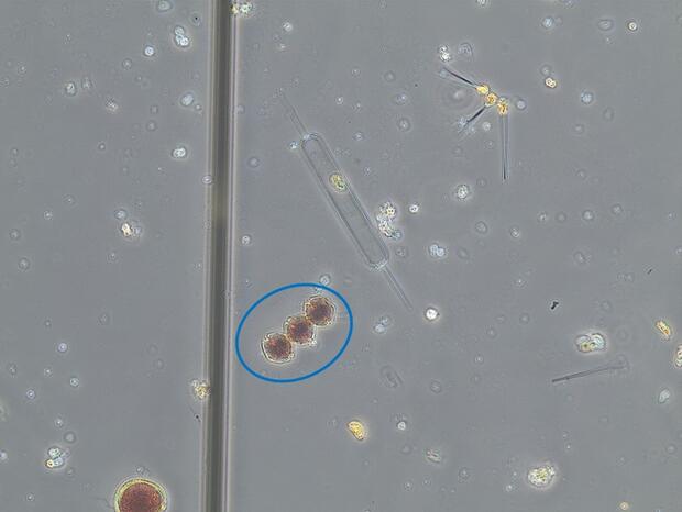 A typical phytoplankton composition of a water sample, with cells of Alexandrium highlighted.