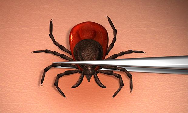 Tick removal from skin with tweezers